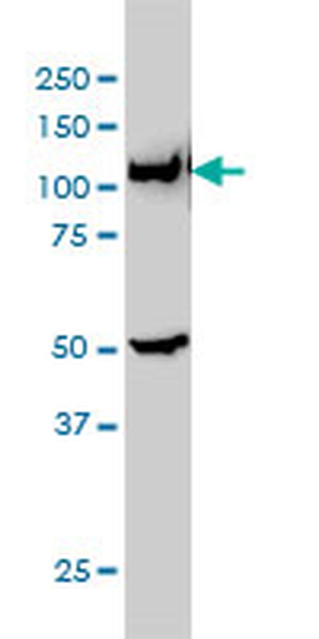 GART Antibody in Western Blot (WB)