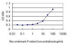 GBA Antibody in ELISA (ELISA)