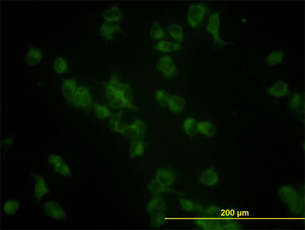 GBA Antibody in Immunocytochemistry (ICC/IF)