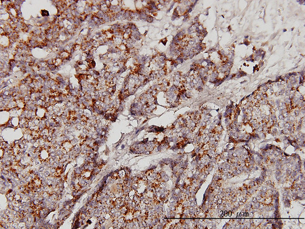 GBA Antibody in Immunohistochemistry (Paraffin) (IHC (P))