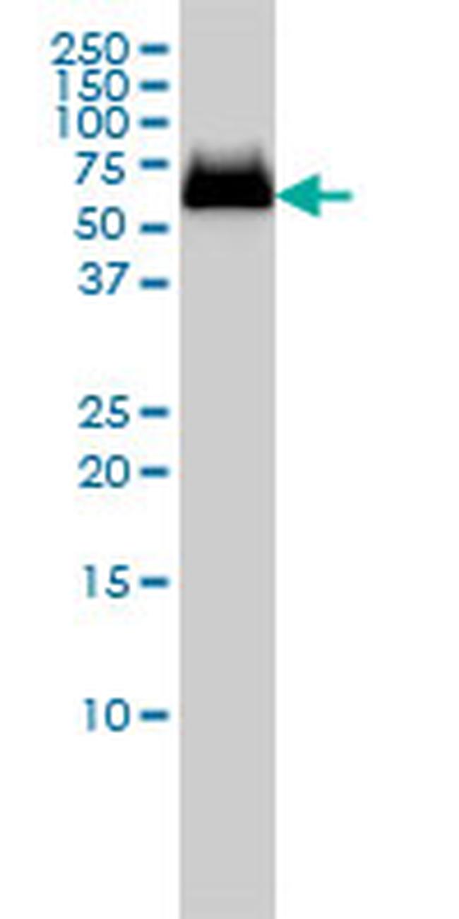 GBA Antibody in Western Blot (WB)