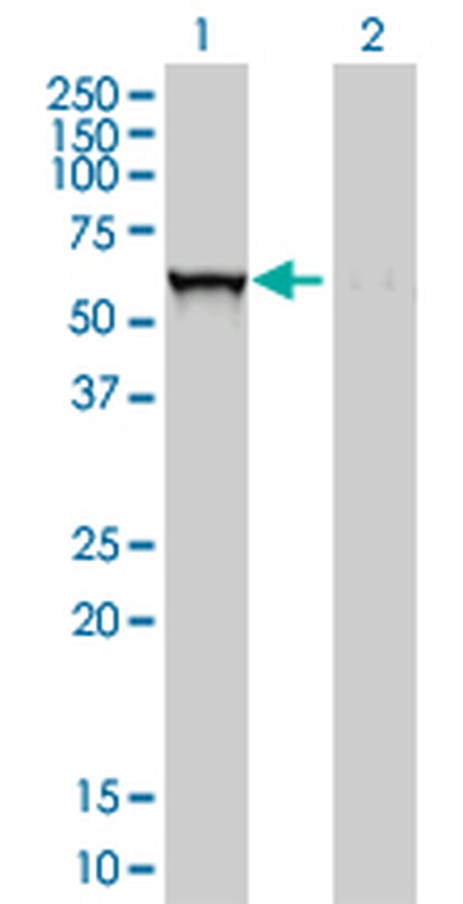 GBA Antibody in Western Blot (WB)