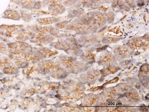 GBP1 Antibody in Immunohistochemistry (Paraffin) (IHC (P))