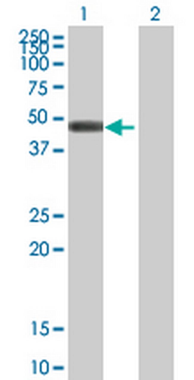 GCDH Antibody in Western Blot (WB)