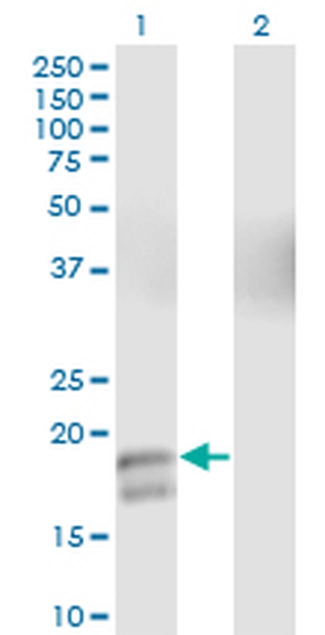 GCG Antibody in Western Blot (WB)