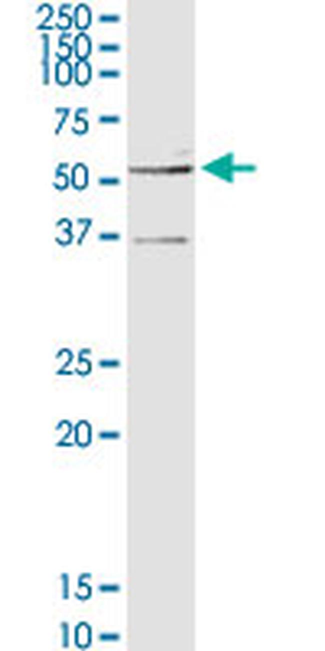 GCK Antibody in Western Blot (WB)