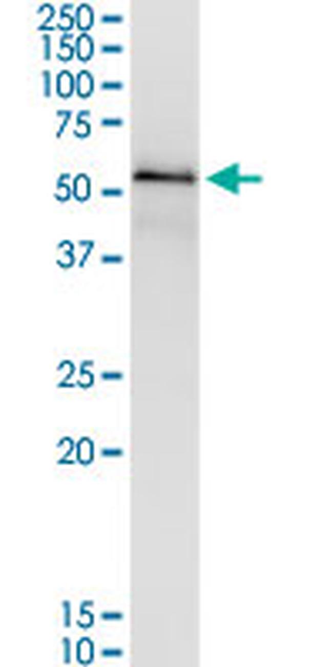 GCK Antibody in Western Blot (WB)