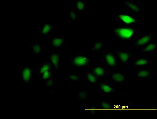 GCN5L2 Antibody in Immunocytochemistry (ICC/IF)