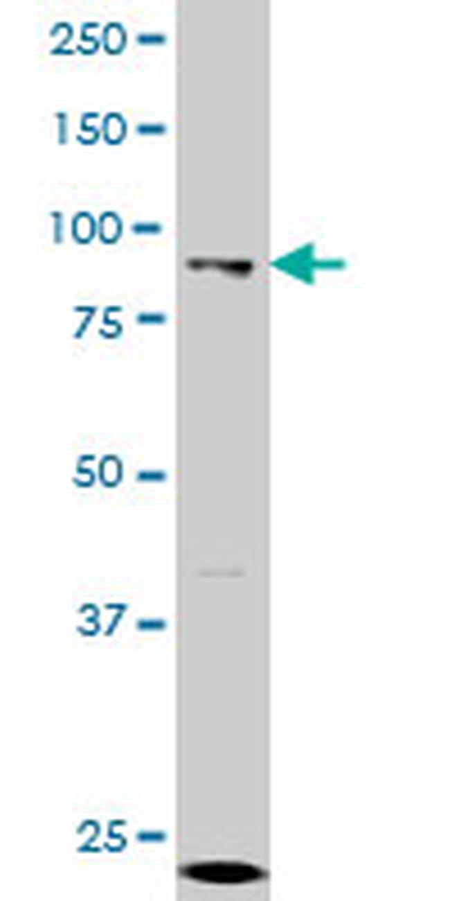 GCN5L2 Antibody in Western Blot (WB)