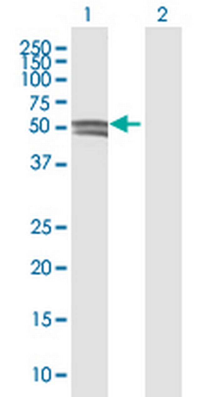 GCNT1 Antibody in Western Blot (WB)