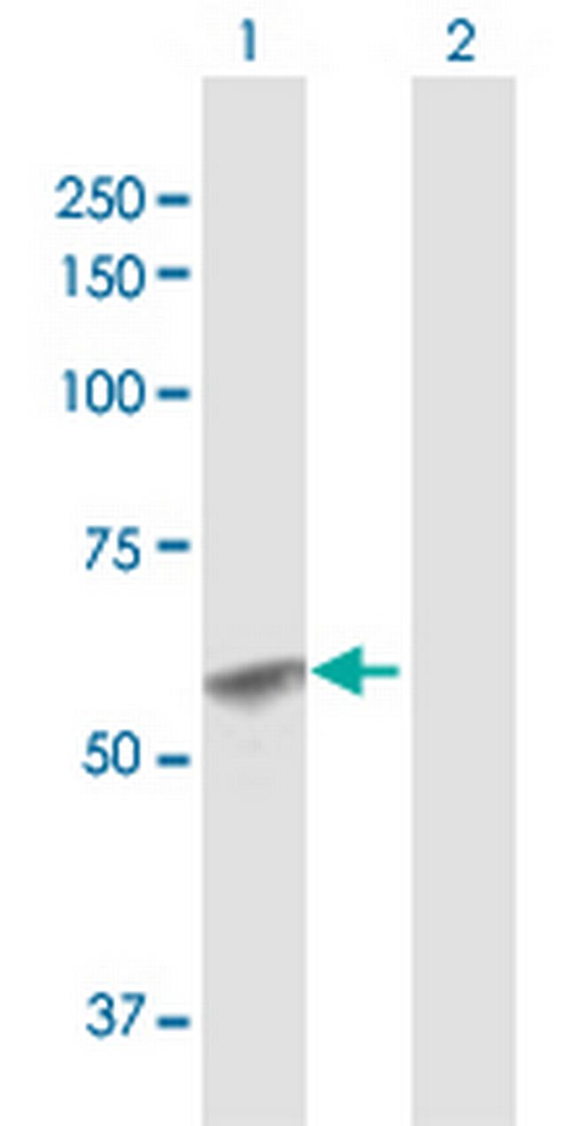 GCNT1 Antibody in Western Blot (WB)