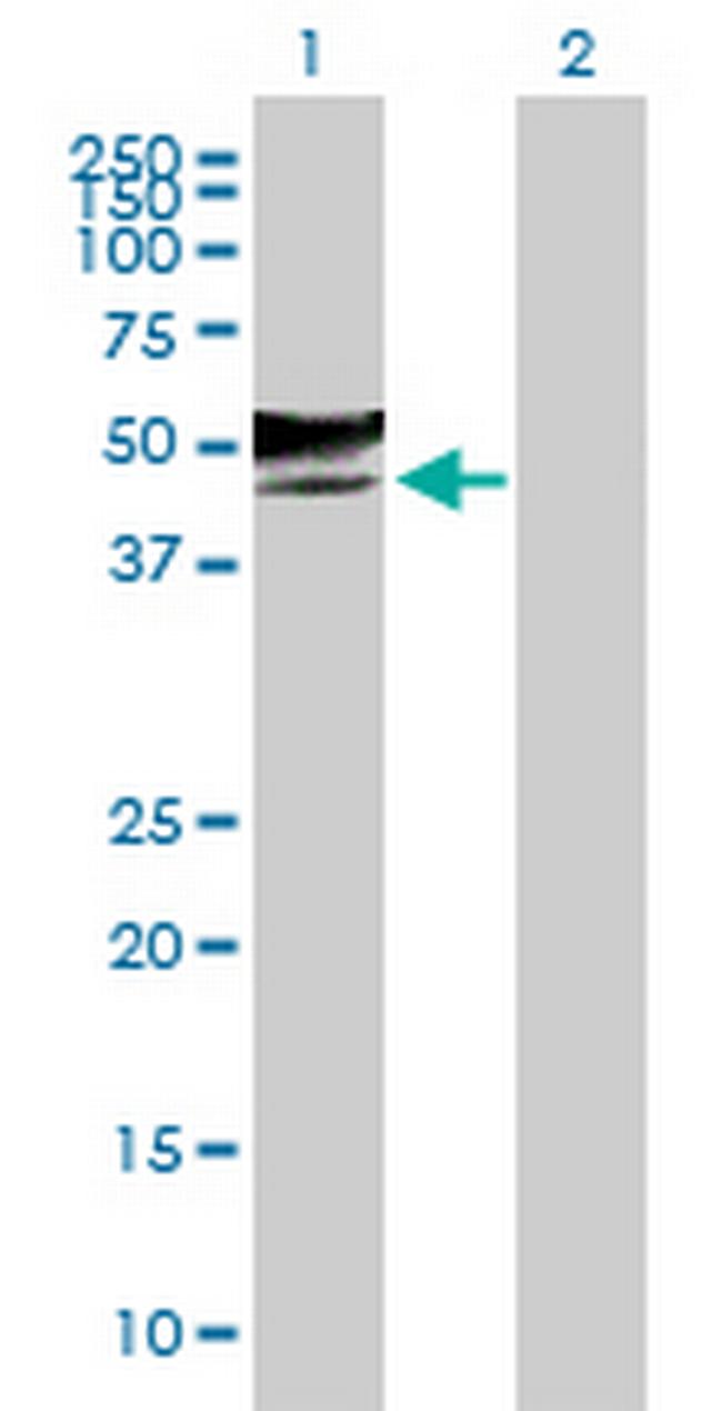 GCNT2 Antibody in Western Blot (WB)