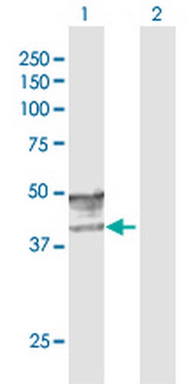 GCNT2 Antibody in Western Blot (WB)