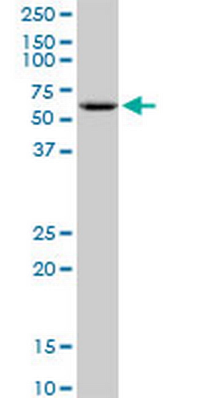 GK2 Antibody in Western Blot (WB)