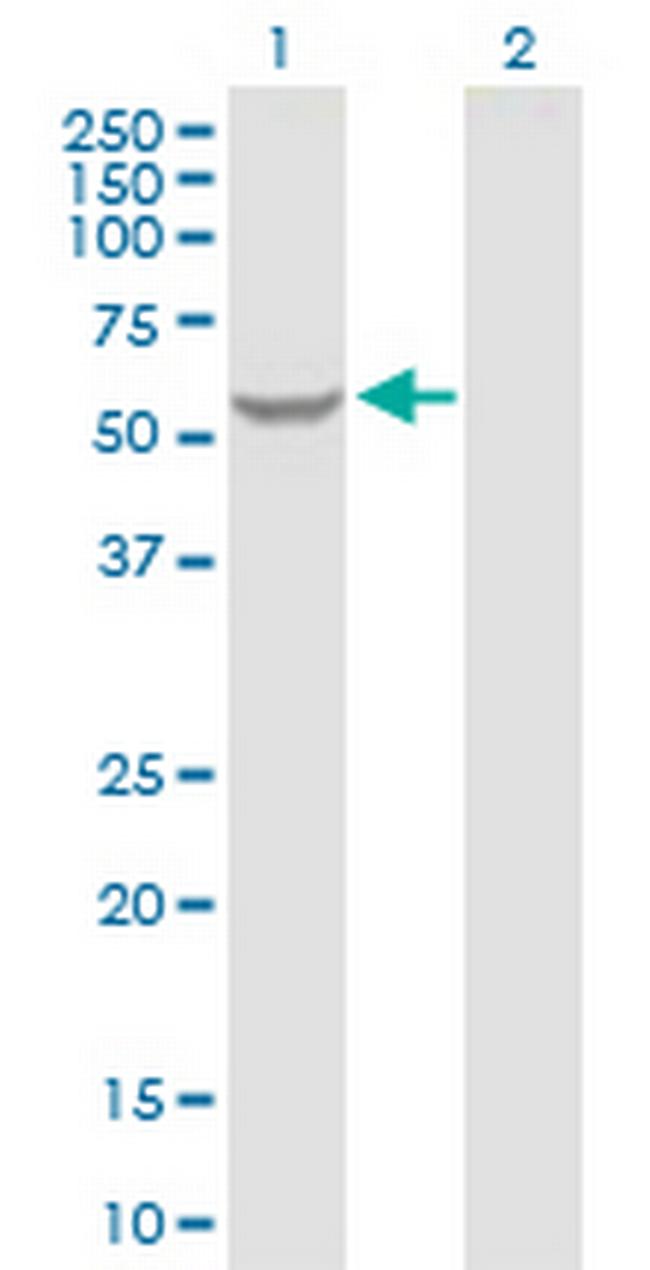 GK2 Antibody in Western Blot (WB)