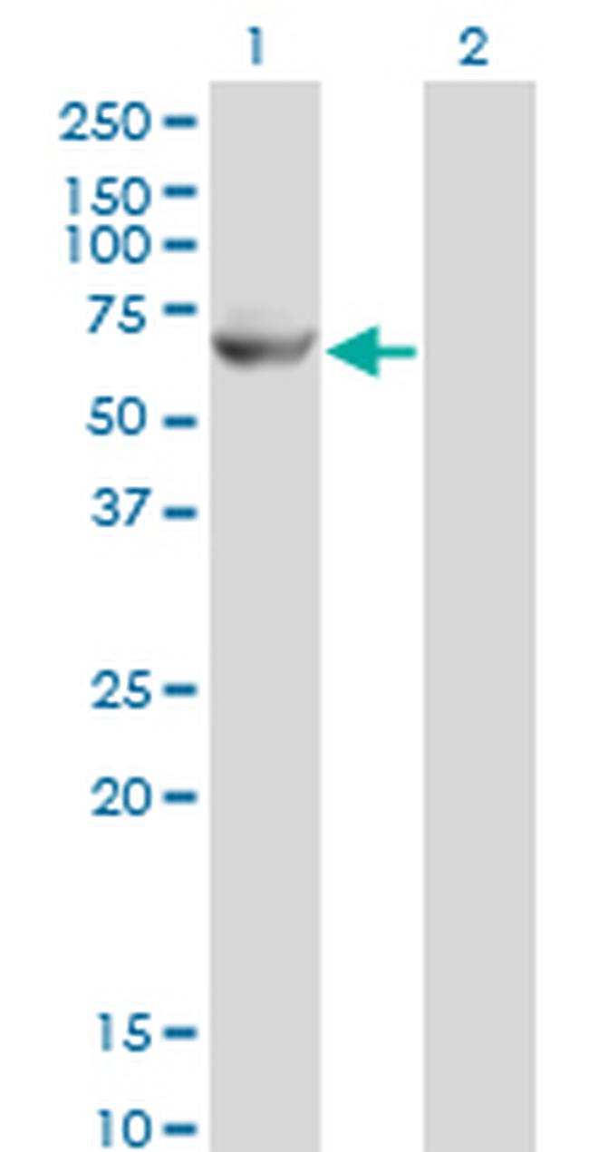 GK2 Antibody in Western Blot (WB)