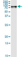 GLB1 Antibody in Immunoprecipitation (IP)