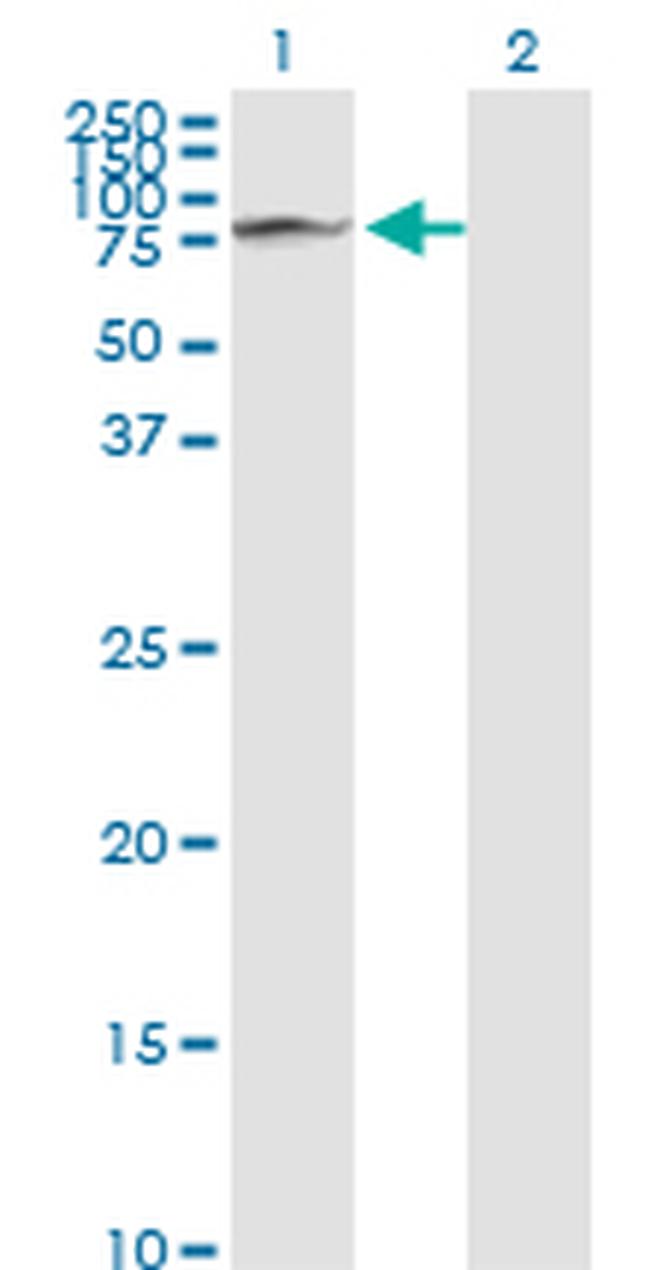 GLB1 Antibody in Western Blot (WB)