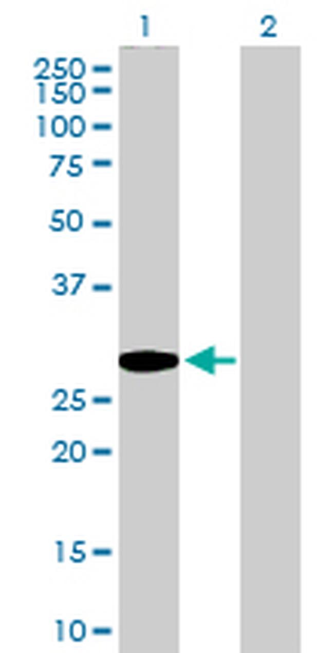 GCLM Antibody in Western Blot (WB)