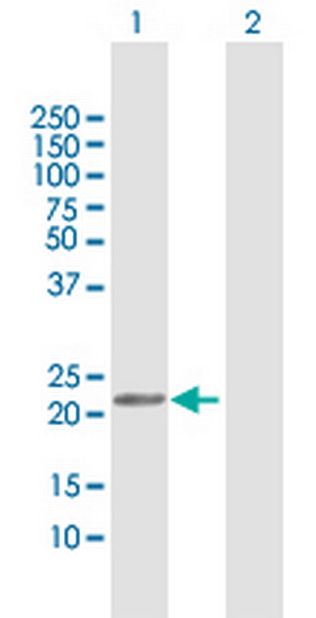 GLO1 Antibody in Western Blot (WB)