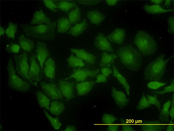 GLS Antibody in Immunocytochemistry (ICC/IF)