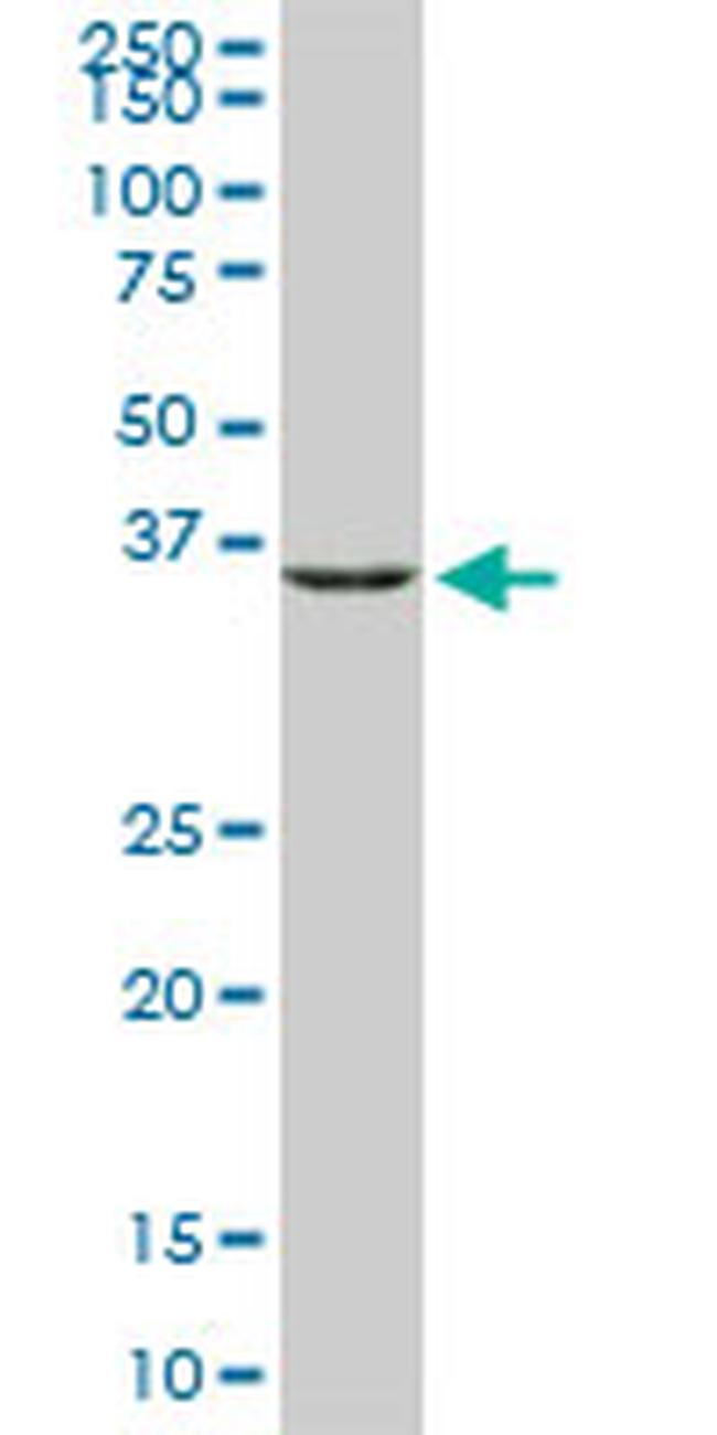 GLUL Antibody in Western Blot (WB)