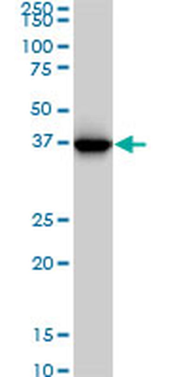 GLUL Antibody in Western Blot (WB)