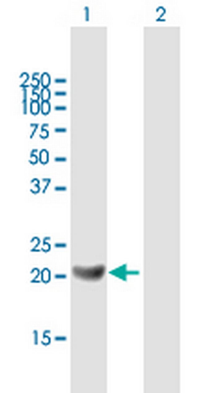 GM2A Antibody in Western Blot (WB)