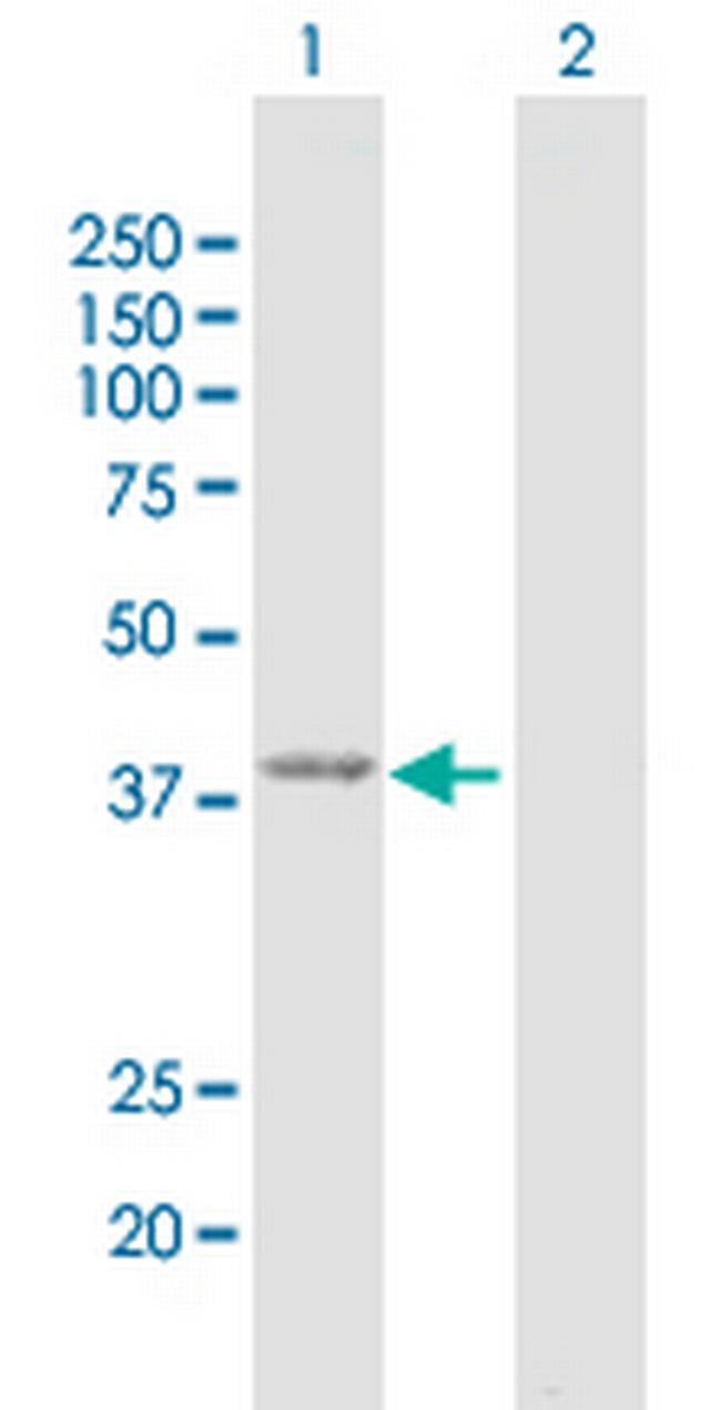 GMDS Antibody in Western Blot (WB)