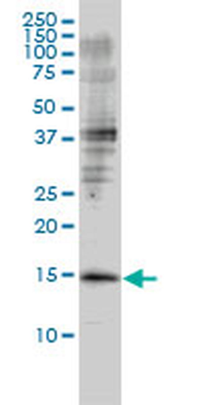 GMFB Antibody in Western Blot (WB)