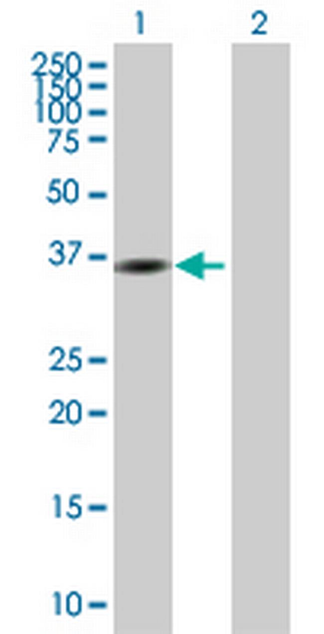 GMPR Antibody in Western Blot (WB)