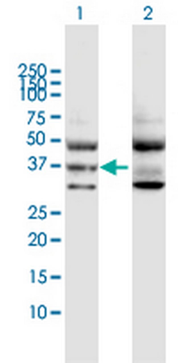 GNA11 Antibody in Western Blot (WB)