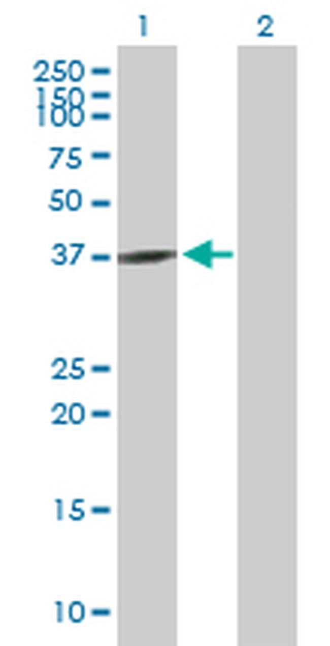 GNAQ Antibody in Western Blot (WB)