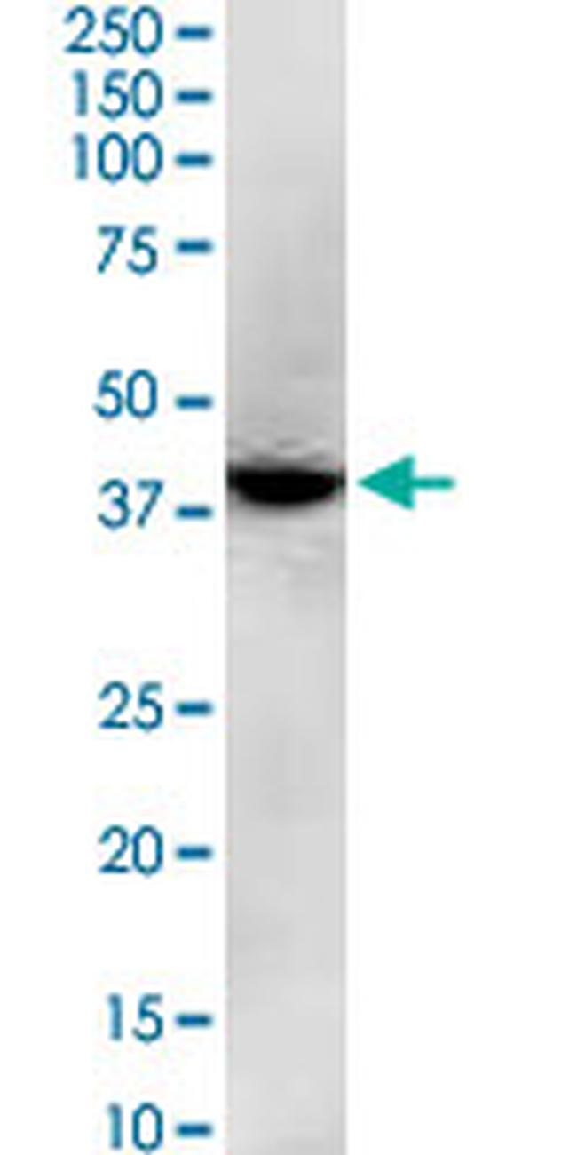 GNAQ Antibody in Western Blot (WB)