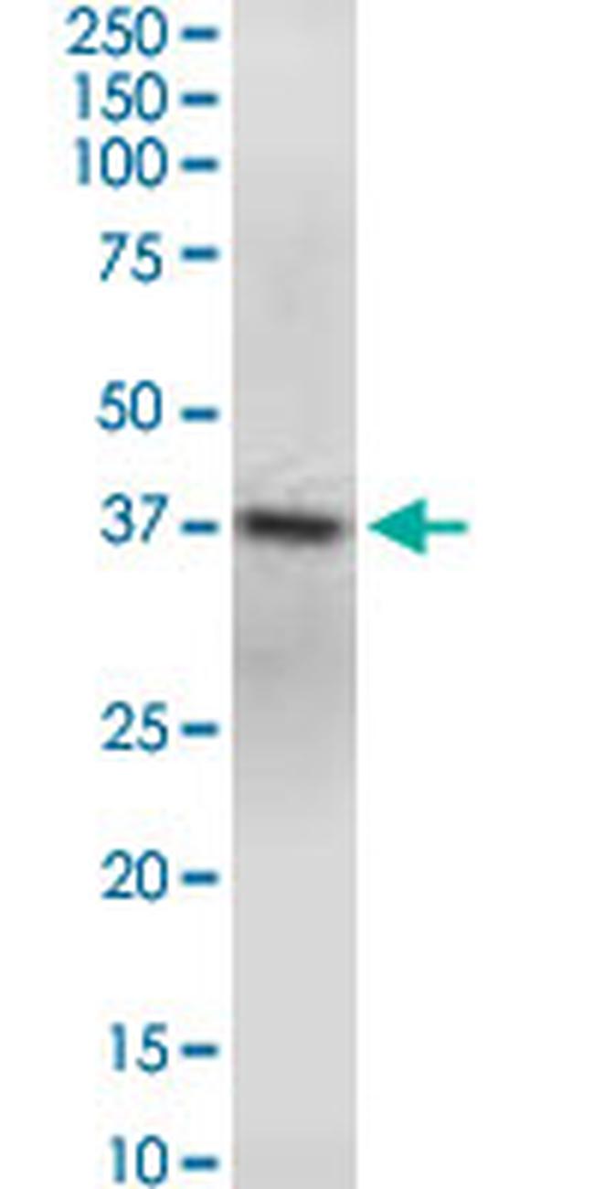 GNAQ Antibody in Western Blot (WB)