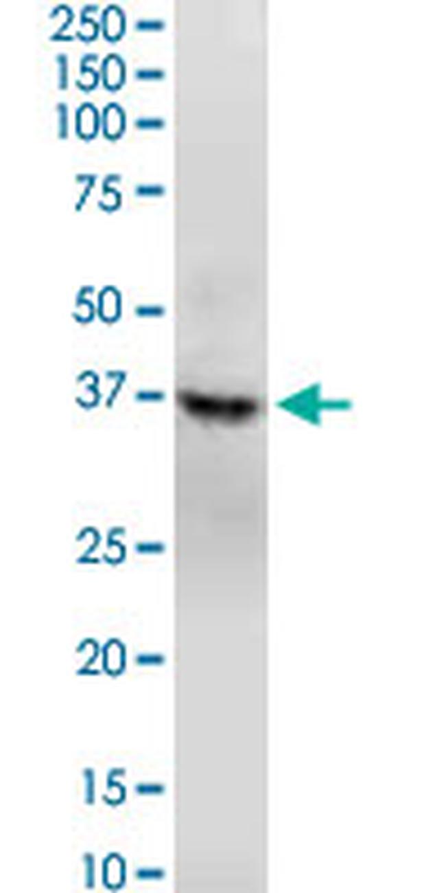 GNAQ Antibody in Western Blot (WB)