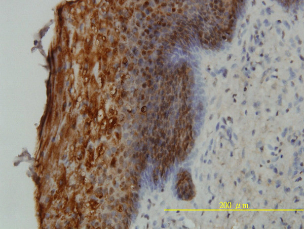 SFN Antibody in Immunohistochemistry (Paraffin) (IHC (P))