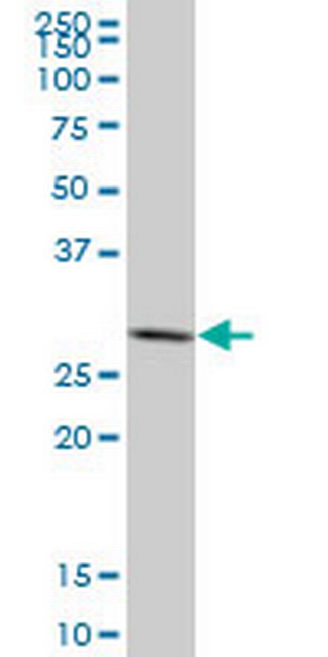 SFN Antibody in Western Blot (WB)