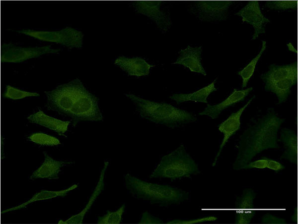 SFN Antibody in Immunocytochemistry (ICC/IF)