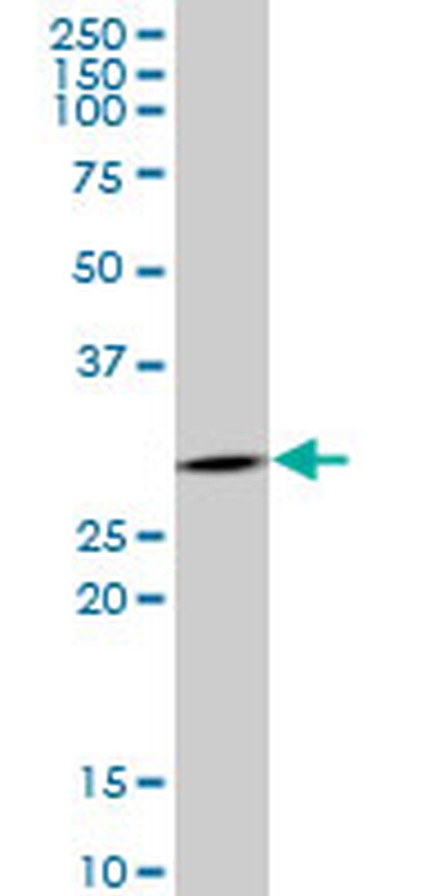 SFN Antibody in Western Blot (WB)