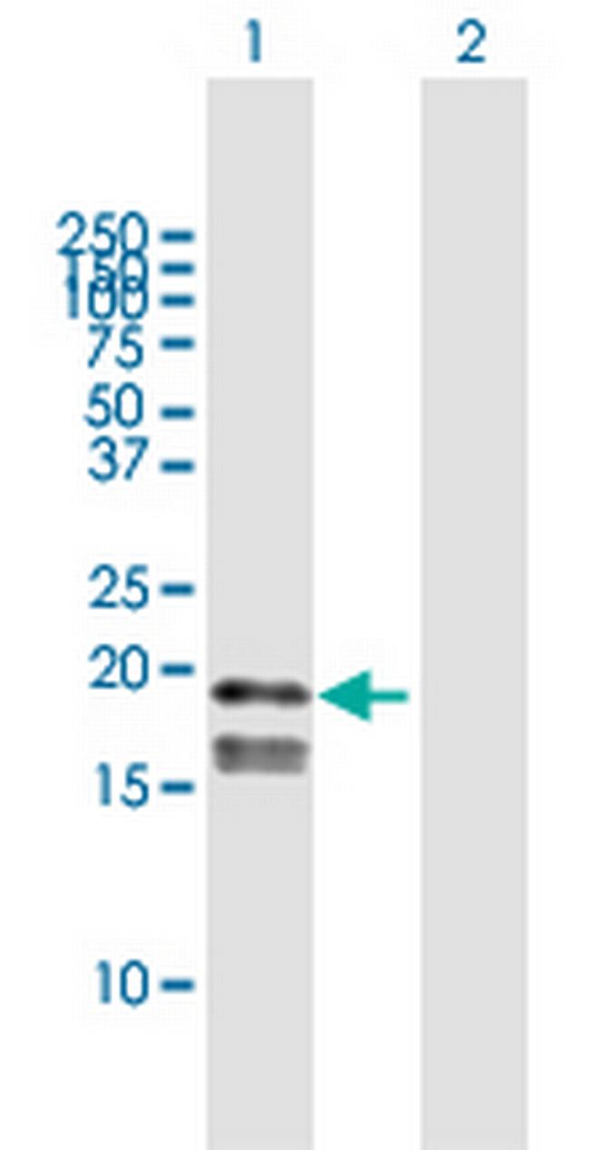 GP9 Antibody in Western Blot (WB)