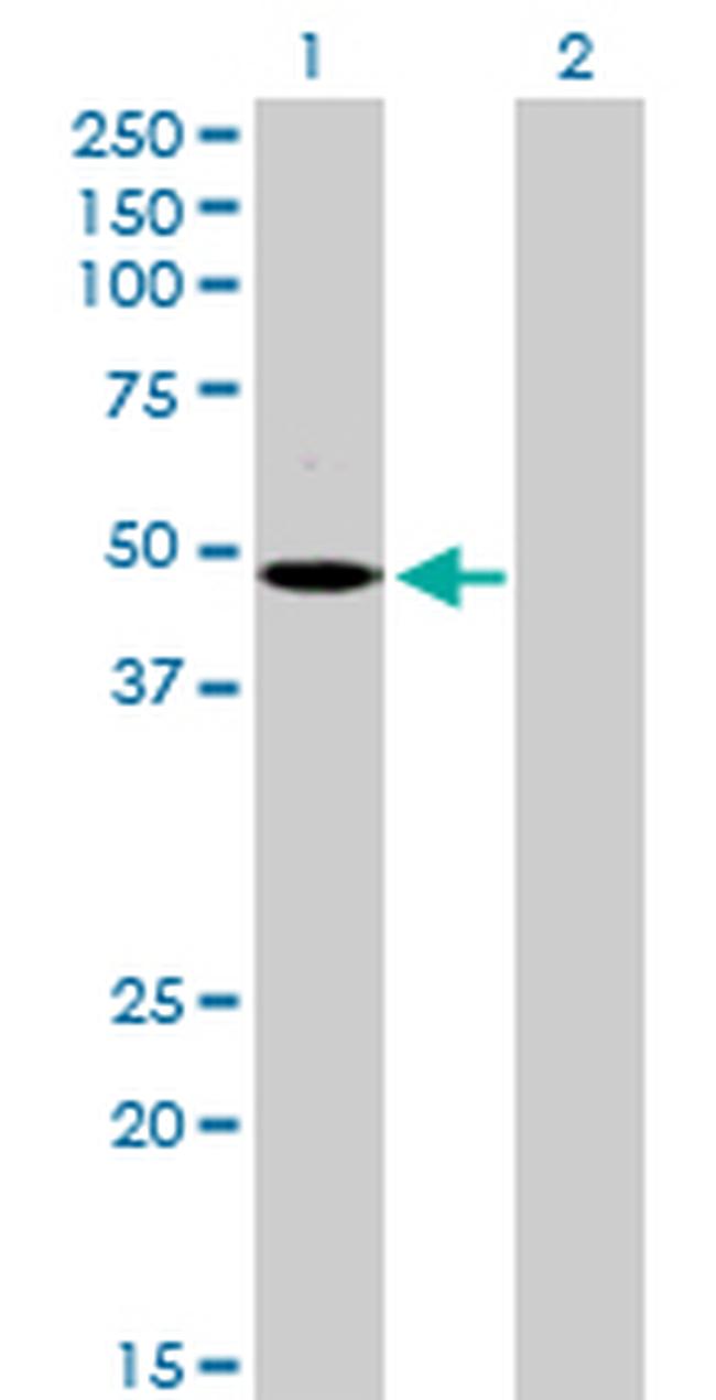 MCHR1 Antibody in Western Blot (WB)