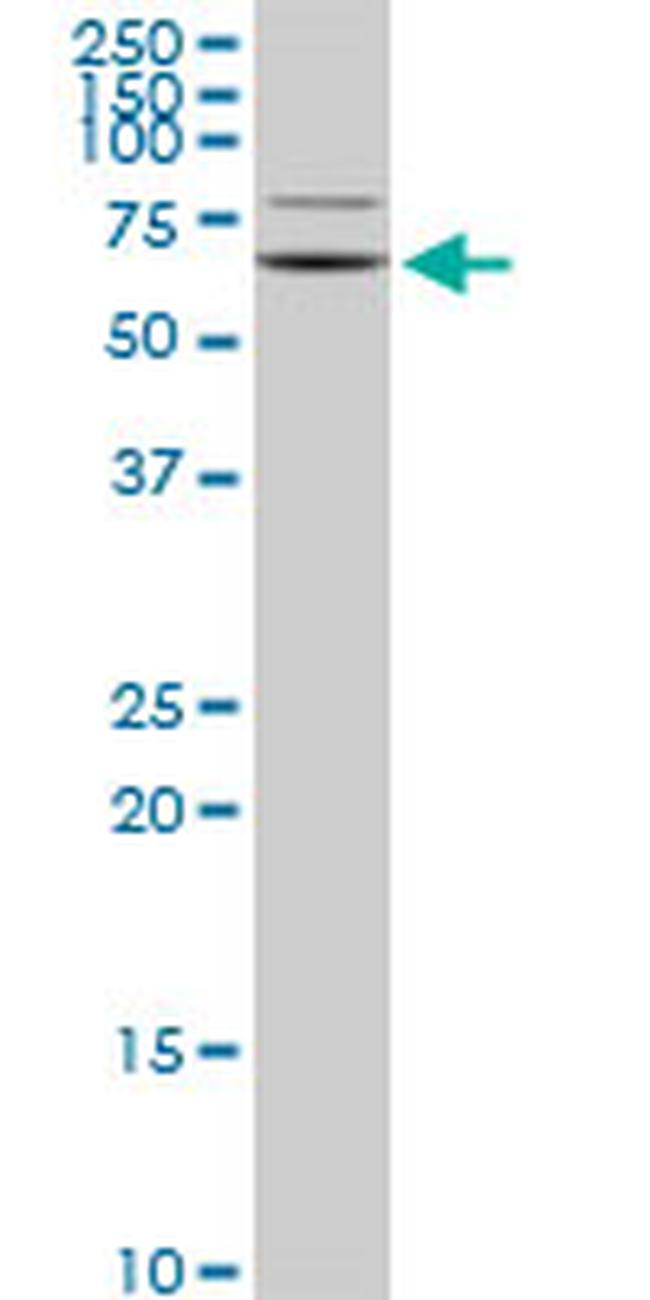 GRK6 Antibody in Western Blot (WB)