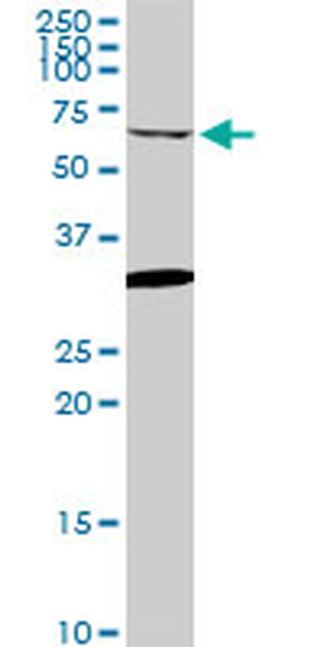 GRK6 Antibody in Western Blot (WB)