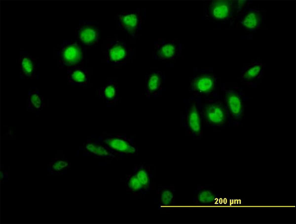 GPS1 Antibody in Immunocytochemistry (ICC/IF)