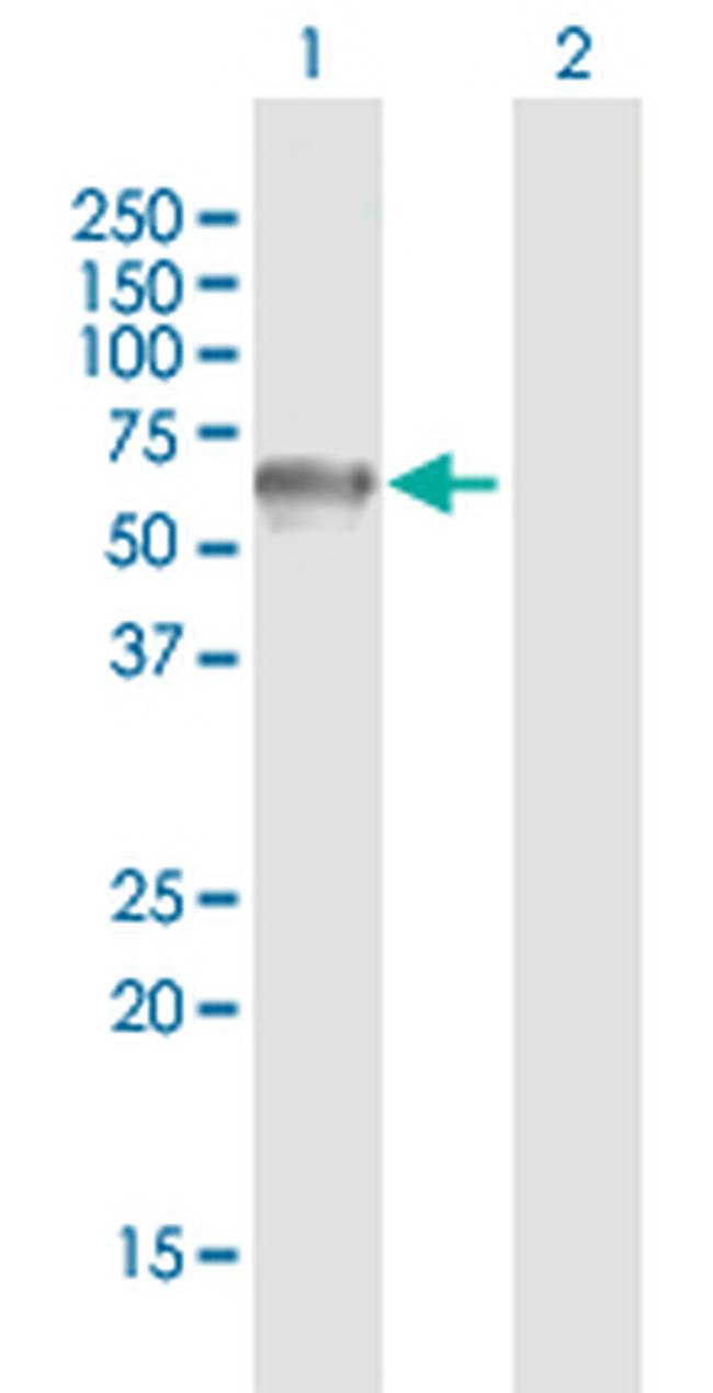 GPS1 Antibody in Western Blot (WB)