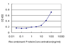 GPT Antibody in ELISA (ELISA)