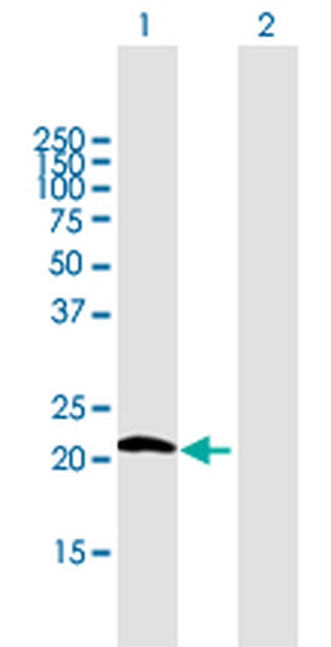 GPX7 Antibody in Western Blot (WB)