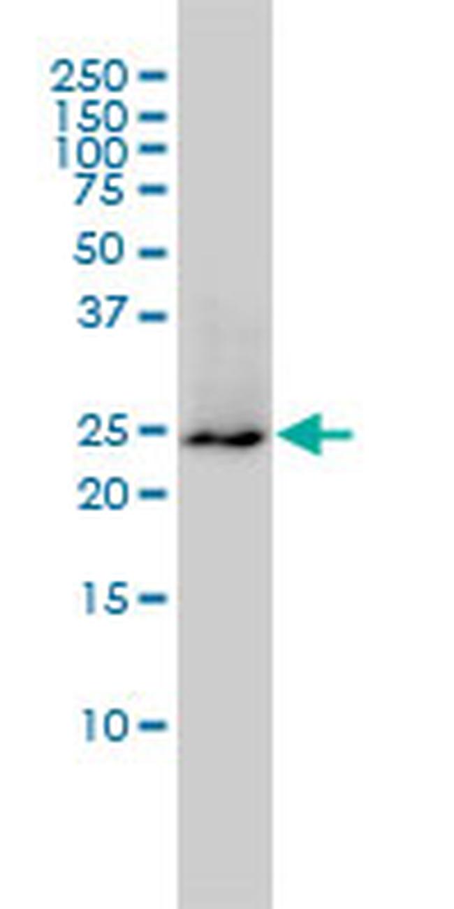 GRB2 Antibody in Western Blot (WB)