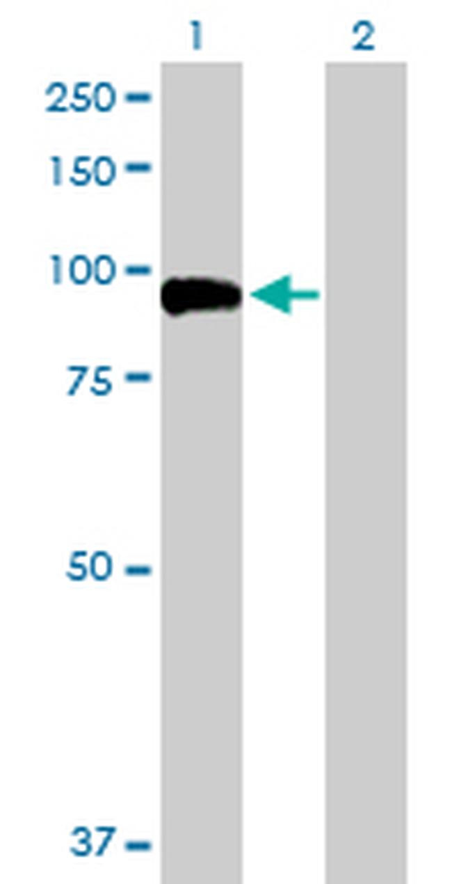 GSN Antibody in Western Blot (WB)